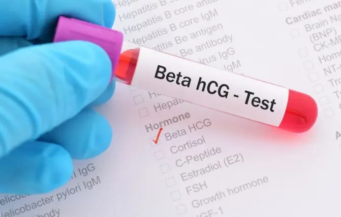 Beta hCG